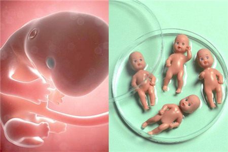 男性因素